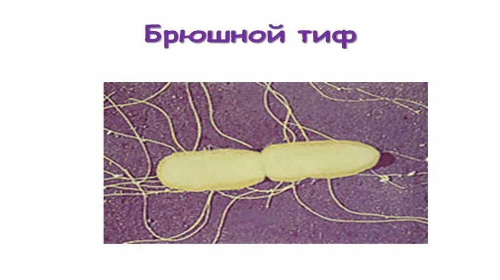 Какие бактерии вызывают тиф. Брюшной тиф инжектисома. брюшной тиф среда обитания.