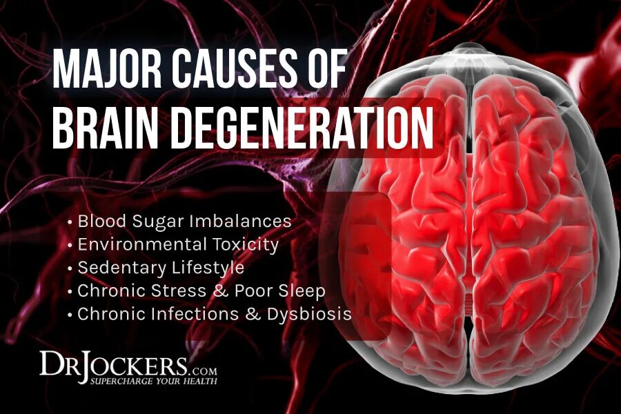 Major cause. Дегенератор. Дегенератор картинка. Bio-Mechanical Degeneration. Die graue Degeneration der hinteren Rückenmarksstränge» книга Лайден.