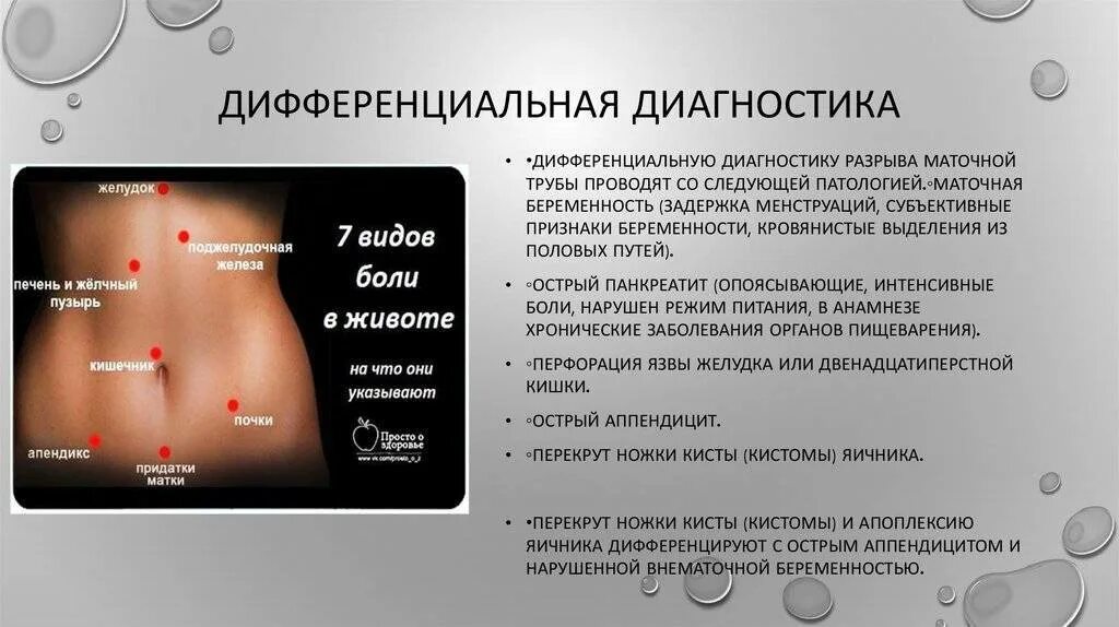Тянет ли живот при месячных. Резкие тянущие боли внизу живота. болит низ живота при беременности. тянет низ живота что это может быть. боль внизу живота при зачатии.