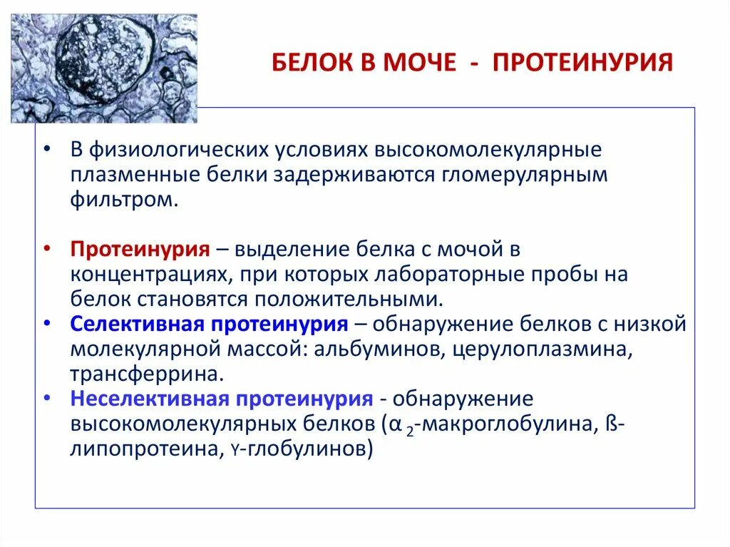 Белок в моче значения. Белок в моче. Белок в моче причины. Белок в моче лекарства. Причины белка в моче.