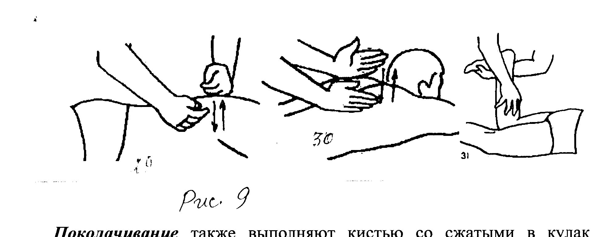 Перкусионный массаж. Ударные приемы в массаже поколачивание. Техника перкуссионного массажа грудной клетки. Перкуссионный массаж грудной клетки. Приемы массажа похлопывание.