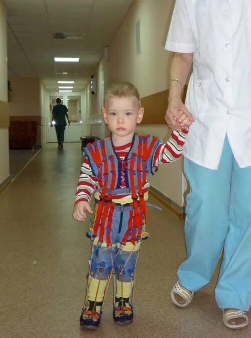 Тетрапарез при дцп. Дцп. дети с дцп. легкая форма дцп у ребенка.