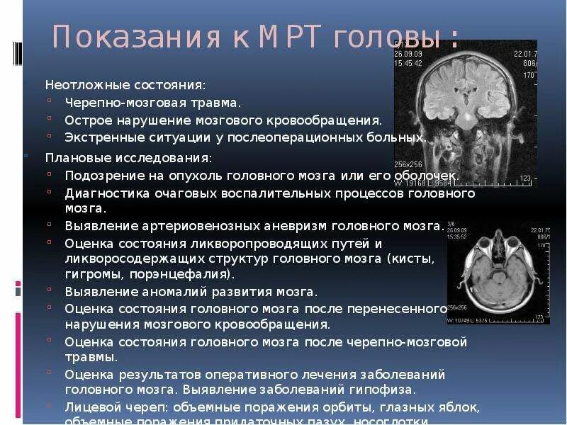 Сколько раз делать мрт головы. Мрт головного мозга показания. показания к мрт головы. показания к проведению мрт головного мозга.