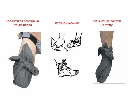 Повязка на культе конечности