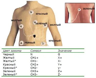 Датчики холтера схема