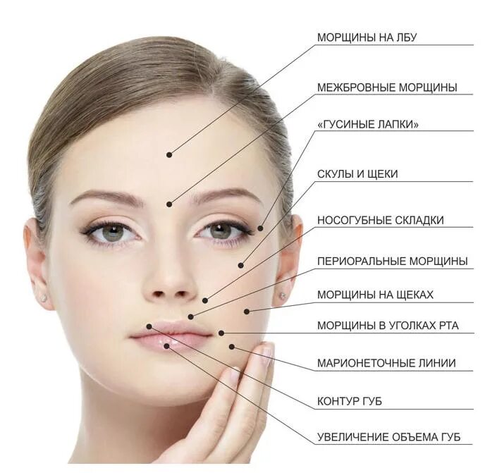 Наименования лиц. Точки уколов ботокса на лице схема. Точки введения ботокса на лице. Схема введения ботокса на лице. Части лица названия.
