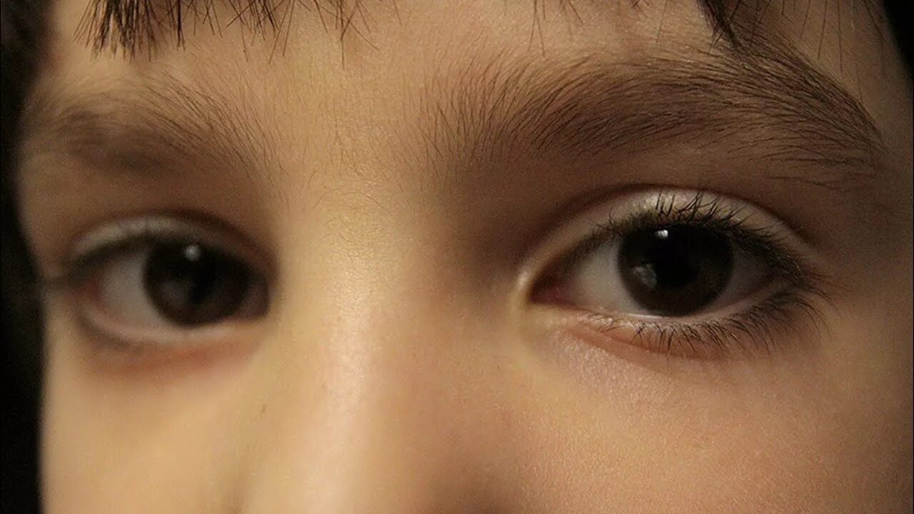 Глаза мальчика. Дети с черными глазами. Черные глаза. Темные глаза. Левый глаз темнее правого