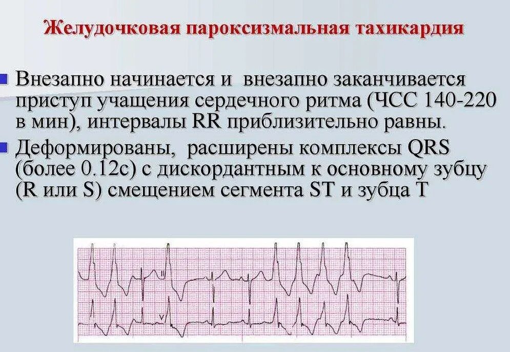 Чсс 140