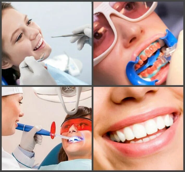 Отбеливание зубов лазером. Чистка и отбеливание зубов. Лазерное отбеливание зубов до и после.