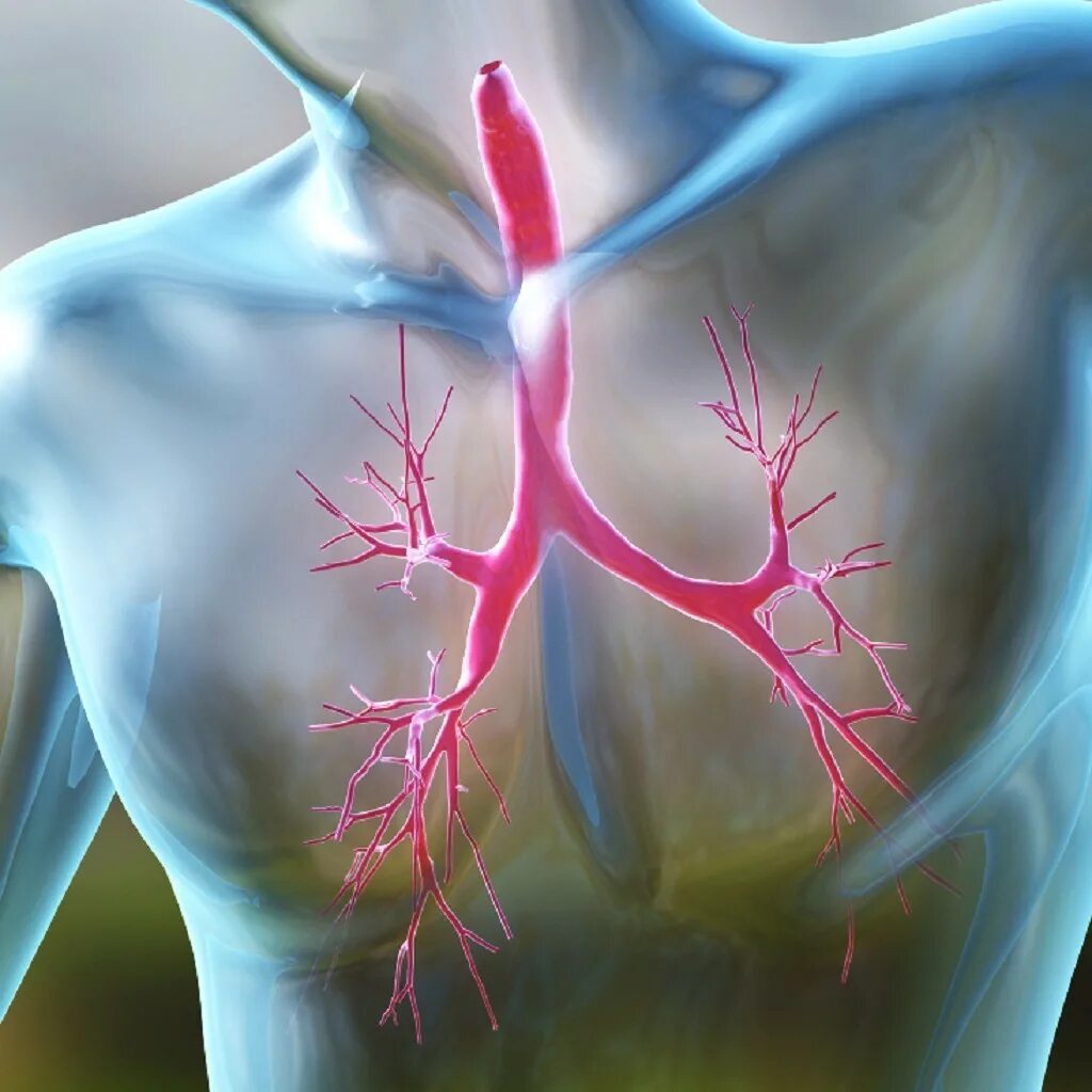 Трахеобронхит без кашля