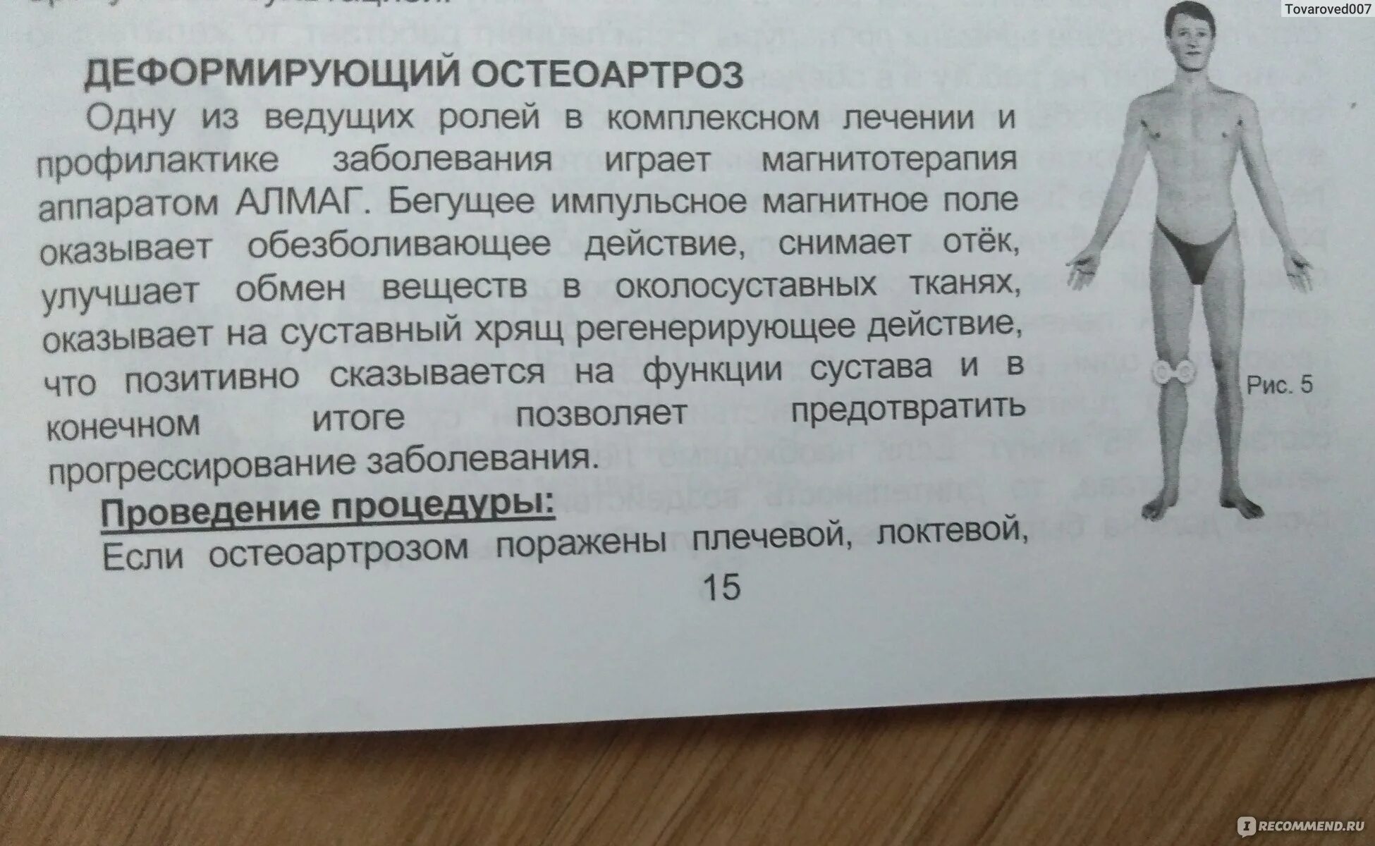 Алмаг колено как правильно. Алмаг-01 сустав. Алмаг-01 инструкция на колено. Как накладывать алмаг 01. Алмаг 01 схемы использования.