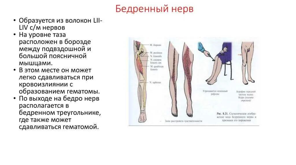 Большеберцовая нейропатия. Симптомы поражения бедренного нерва неврология. Невропатия бедренного нерва анатомия. Синдром поражения бедренного нерва. Бедренный нерв симптомы поражения.