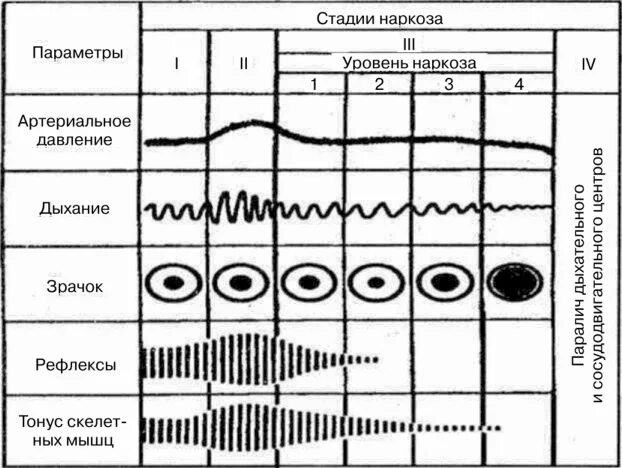 Хирургическая стадия наркоза. Схема стадий наркоза. Стадии ингаляционного эфирного наркоза. Стадии течения эфирного наркоза. 1 Стадия наркоза показатель.