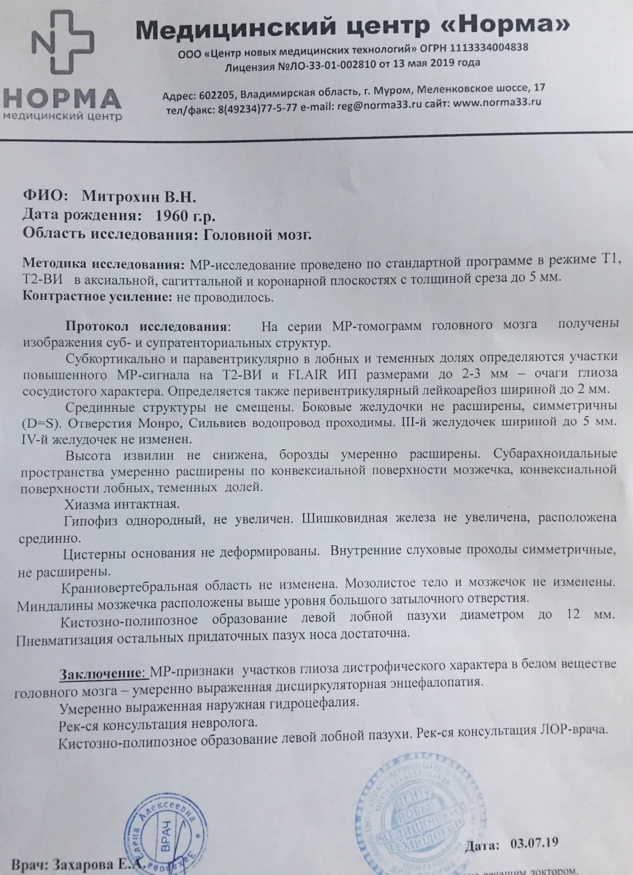 Мрт головного мозга глиоз заключение. Глиоз сосудистого генеза головного мозга. Описание мрт головы с заключением. Глиоз в головном мозге на мрт.