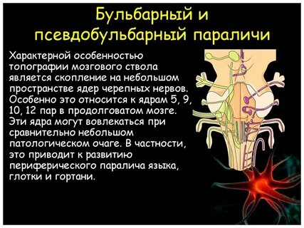 Бульбарный