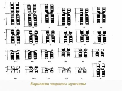 20 кариотип