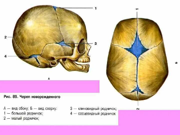 Швы черепа вид сбоку. Роднички новорожденного анатомия черепа. Швы и роднички черепа анатомия. Швы костей черепа.