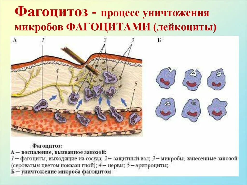 Воспаление фагоцитоз лейкоцит безразличный раздражитель микроворсинка. Процесс фагоцитоза. Фагоцитоз микроорганизмов. Фагоцитоз лейкоцитов. Лейкоциты и фагоциты.