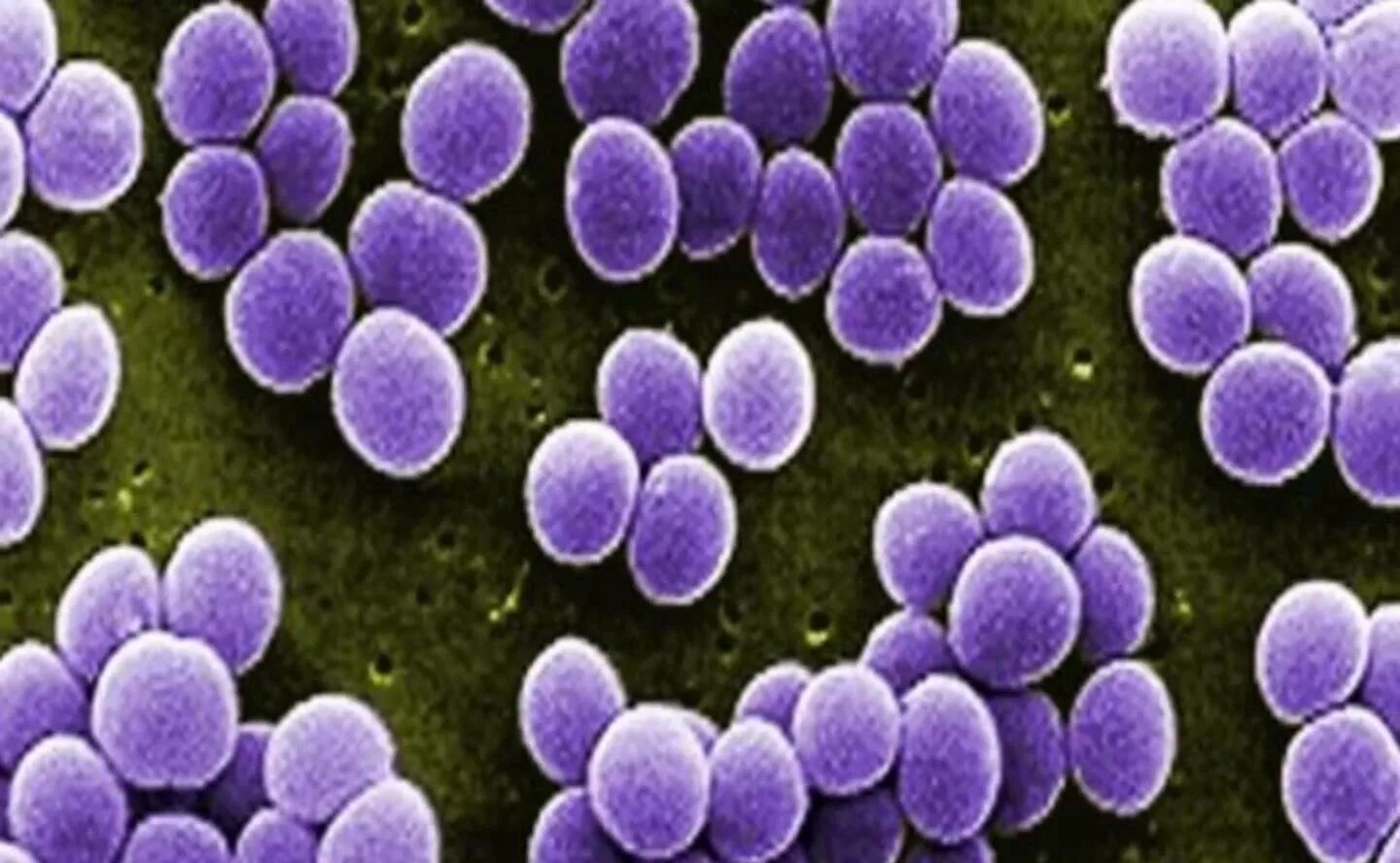 2 staphylococcus aureus