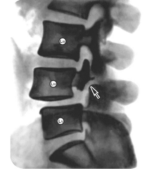 L 5 3