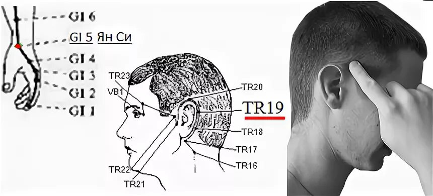 Боль головы над ухом. Болевая точка за ухом. Болит при надавливании на голове над ухом. Над ухом болит точка при нажатии.