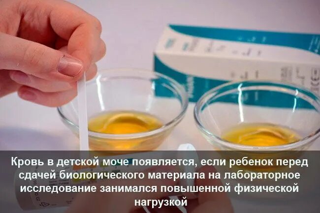 Что можно вылечить мочой