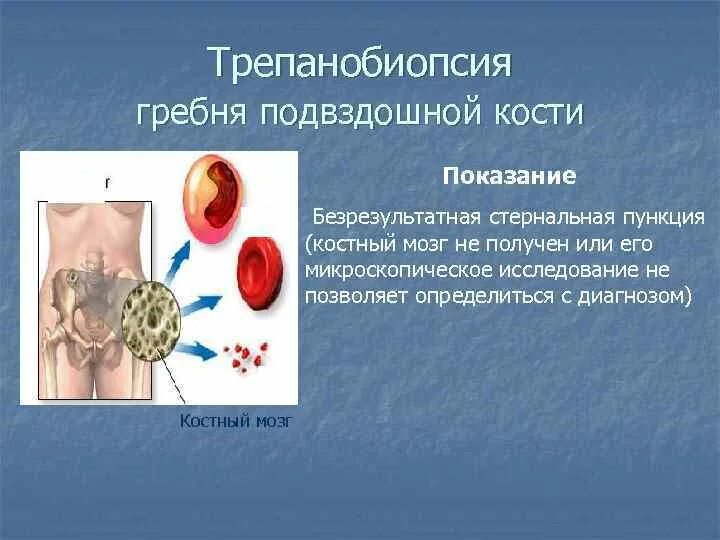 Костный мозг жидкость. Трепанобиопсия крыла подвздошной кости. Пункция из подвздошной кости. Трепанобиопсия костного мозга. Трепанобиопсия из подвздошной кости.