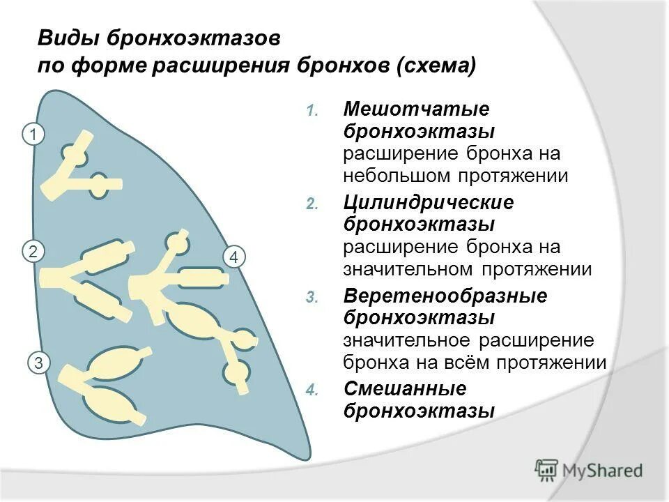 Как лечить бронхоэктазы. Бронхоэктазы классификация кт. цилиндрические бронхоэктазы схема. веретенообразные бронхоэктазы на кт. мешковидные бронхоэктазы.