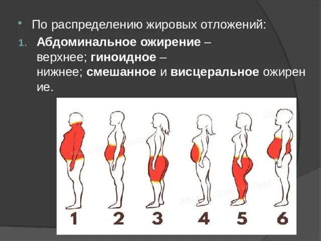 Типы ожирения по типу распределения жировой ткани. Висцеральный и абдоминальный Тип ожирения. Гиноидный Тип распределения жировой ткани. Висцеральный Тип ожирения.