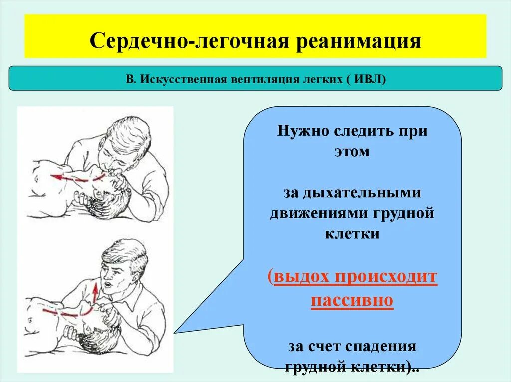 СЛР искусственная вентиляция легких. Сердечно легочная реанимация искусственная вентиляция легких. Сердечно легочная реанимация ИВЛ. Легочно сердечная реанимация обучение