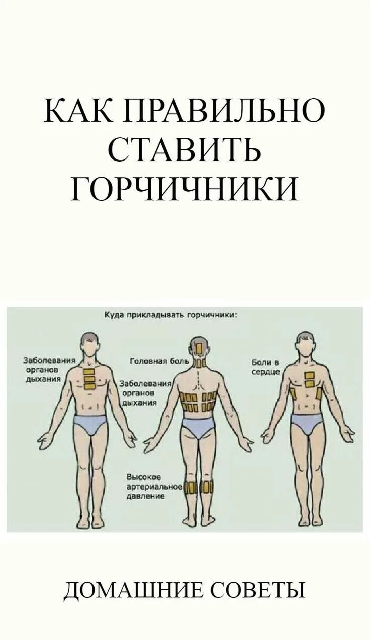 Сколько раз ставить горчичники. Как правильно ставить горчичники. Как правильно поставить горчичники. Куда ставить горчичники. Как правильно поставить горчи.