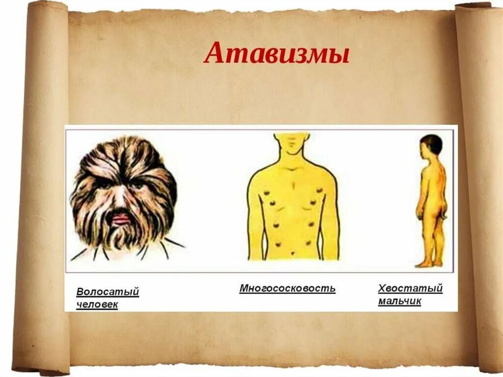 Атавизмы атавизмы случаи. Атавизмы у человека многососковость. Почему у отдельных людей атавизмы. Атавизмы доказательства. Почему у отдельных людей атавизмы.