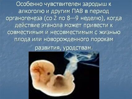 Эмбриона какие причине