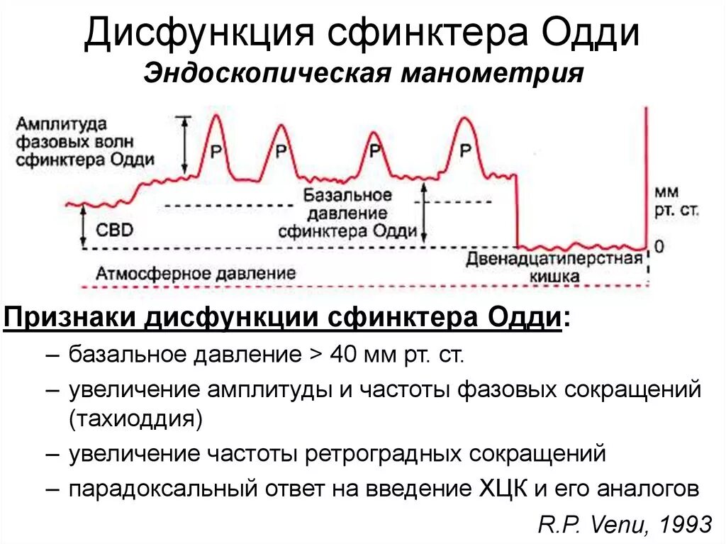 Манометрия сфинктера Одди. Дисфункция сфинткера один. Сфинктер Одди дисфункция симптомы. Нарушение функции сфинктера.