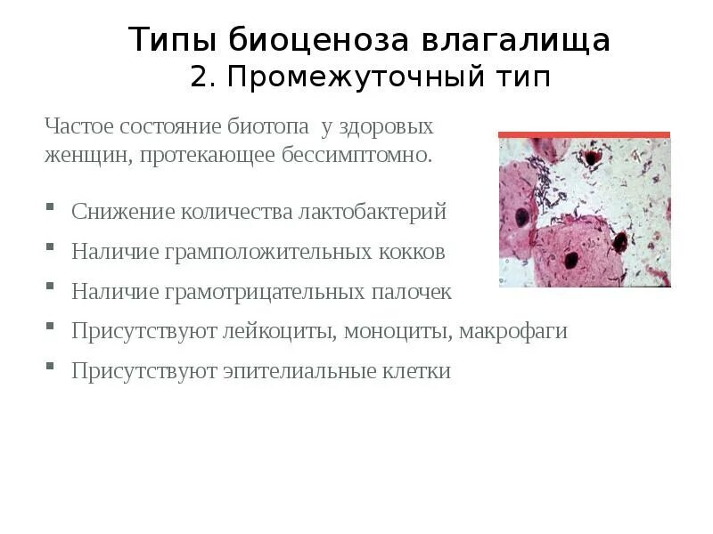 Дисбиоз в гинекологии у женщин. Промежуточный Тип мазка. Типы биоценоза влагалища. Промежуточный Тип микробиоценоза влагалища:. Биоценоз влагалища норма.