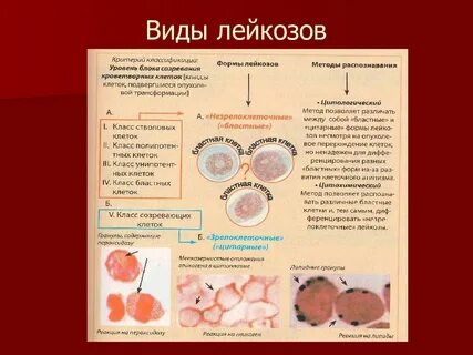 Острый лейкоз клеточного типа