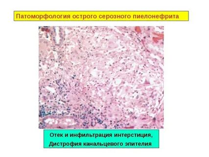 Патоморфология