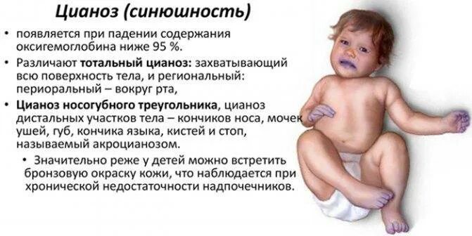 Синие губы при температуре у ребенка