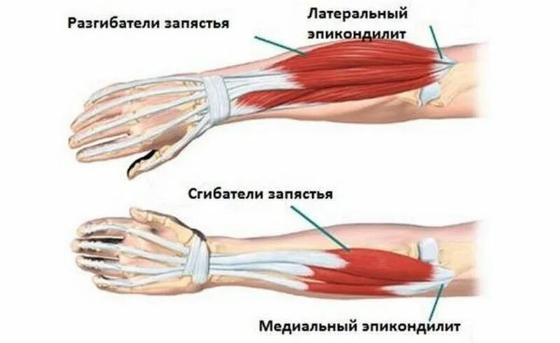 Почему дергается локоть