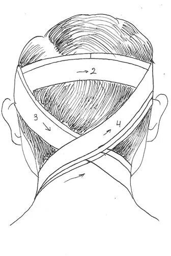 Техника наложения крестообразной повязки. Техника наложения крестообразной повязки на затылок. Крестообразная повязка на затылок алгоритм. Восьмиобразная повязка на затылок и шею. Крестообразная повязка на затылок показания.
