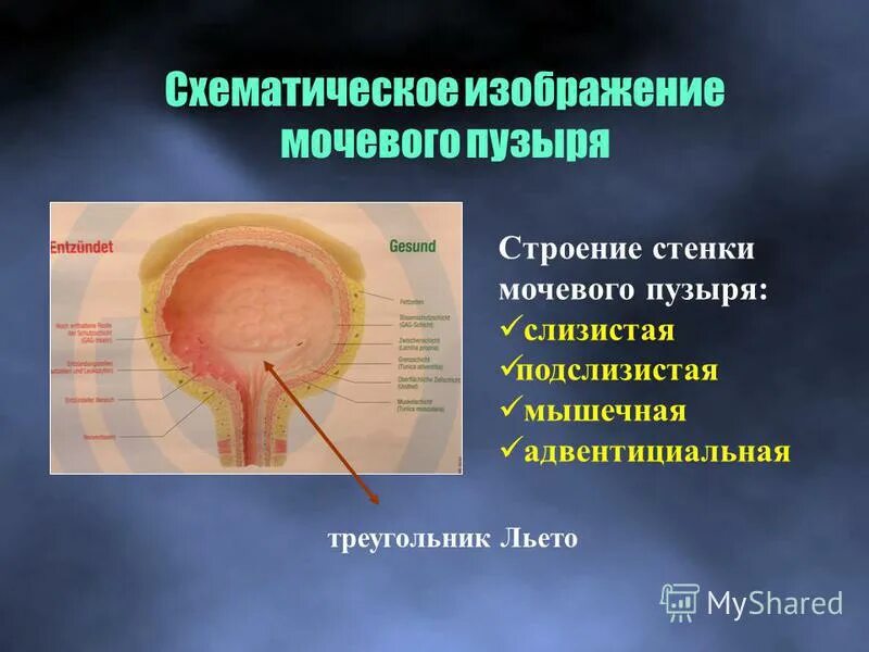 Содержимое мочевого пузыря. Строение стенки мочевого пузыря. треугольник мочевого пузыря. стенкеии мочевого пузыря. треугольник льето мочевого пузыря.