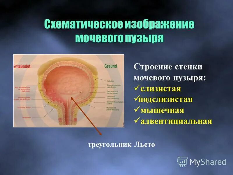 Слои стенки мочевого пузыря. Строение стенки мочевого пузыря. Треугольник мочевого пузыря. Стенкеии мочевого пузыря. Треугольник Льето мочевого пузыря.