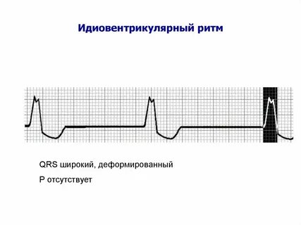 Переживание ритма