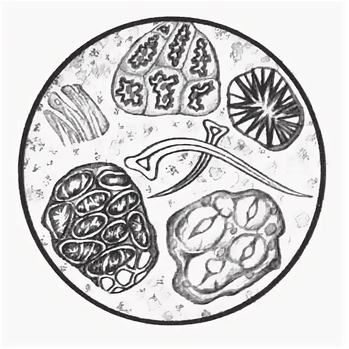 Растительная неперевариваемая клетчатка в кале у взрослого. Микроскопия кала растительная клетчатка непереваримая. Переваренная клетчатка микроскопия. Копрология растительная клетчатка перевариваемая. Преваваримая клетчатка в Кале.