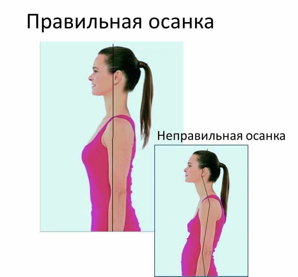 Как выглядит осанка. Осанка. правильная осанка. неправильная осанка. правильная и неправильная осанка.