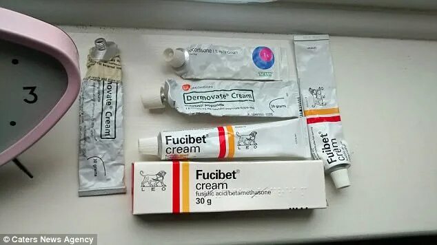 Кортизон и гидрокортизон. Стероидный крем. Крема со стероидными гормонами. • клобетазона бутират 0,05 %. Что такое анаболики в кремах.