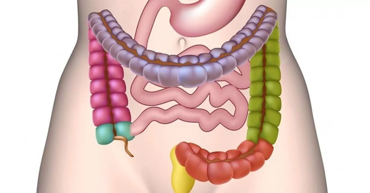 Толстая кишка запор