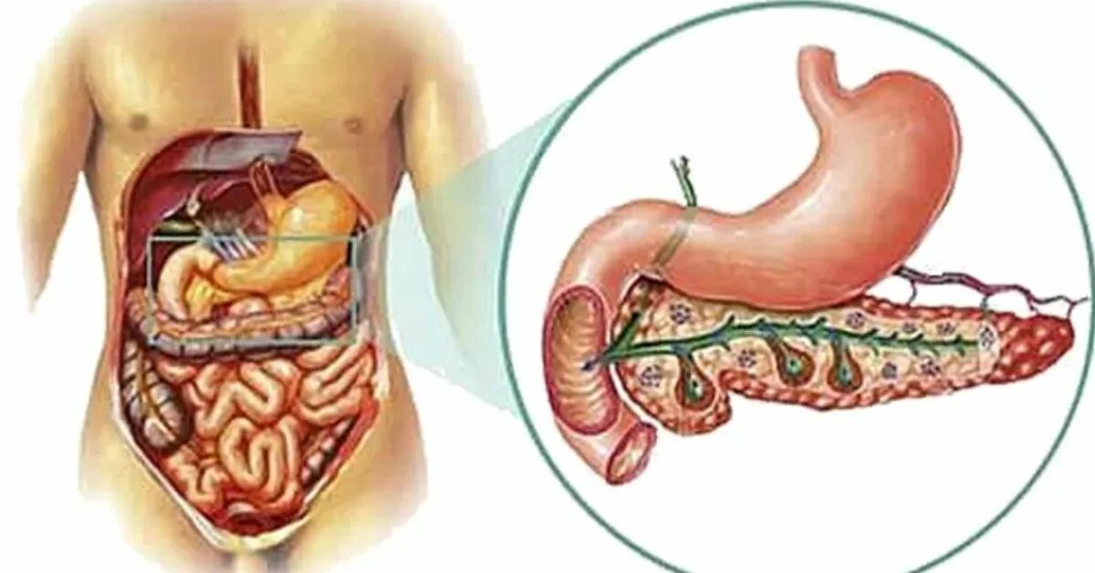 Поджелудочная железа отечность