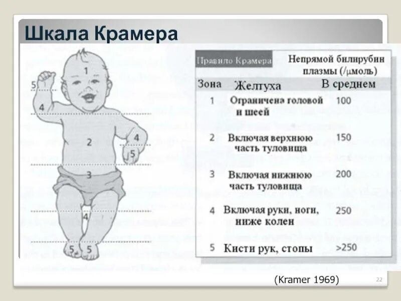 Билирубин выписка из роддома у новорожденных. Желтушка у новорожденного норма билирубина. билирубин норма у новорожденных 1 месяц аппарат. норма желтушки у новорожденных по прибору. норма желтушки у новорожденных по прибору в месяц.