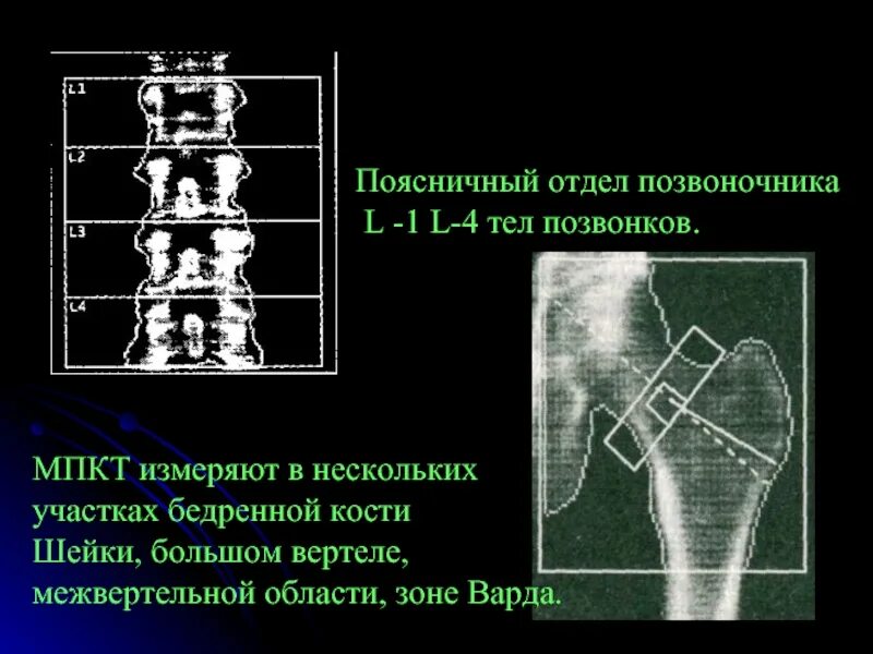 Поясничный отдел l1